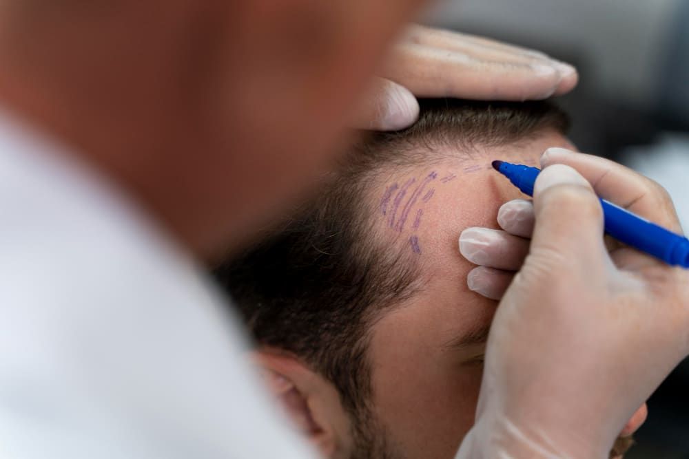 Natuurlijke haarlijnen