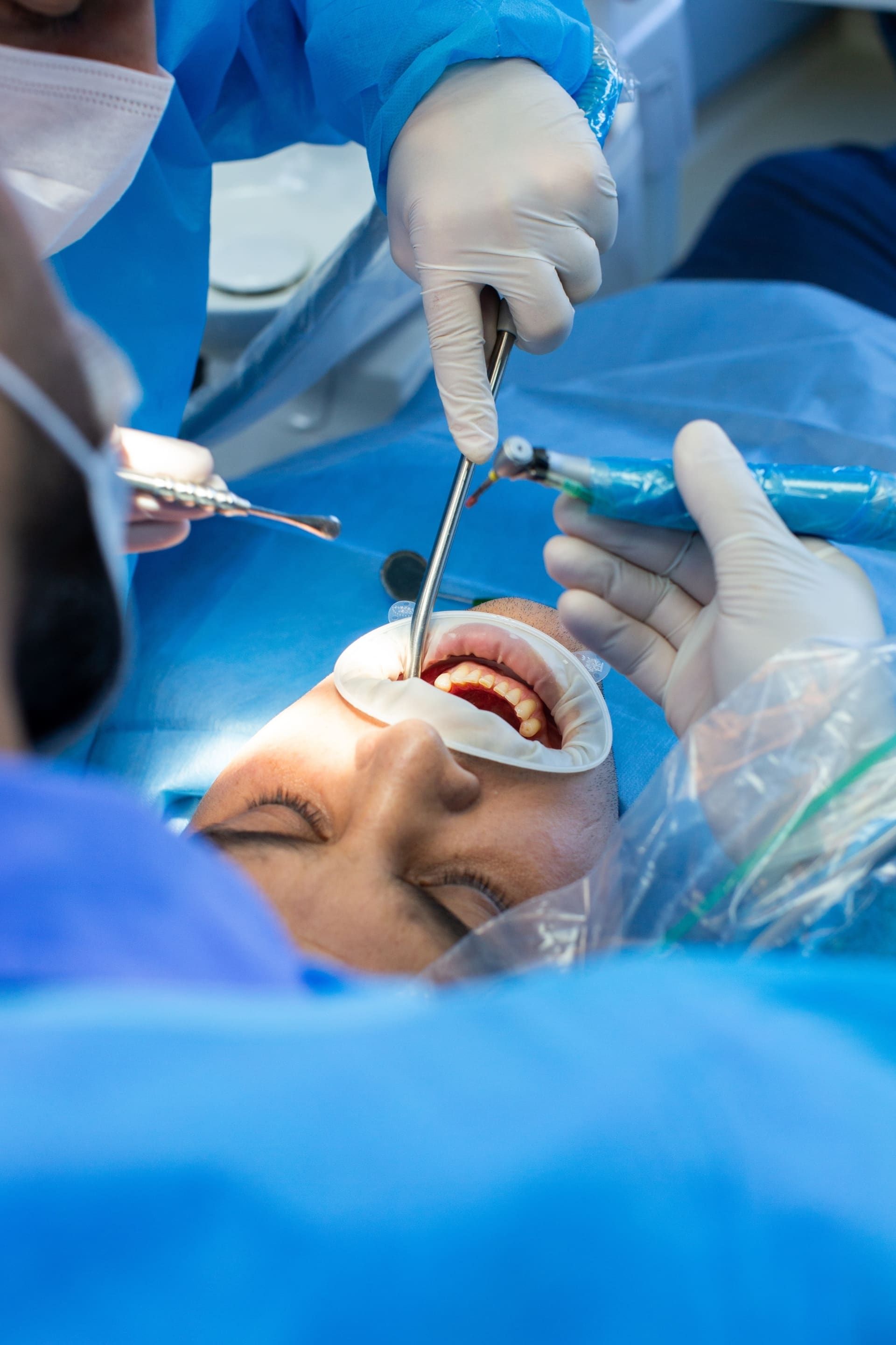 Tandheelkundige chirurgie